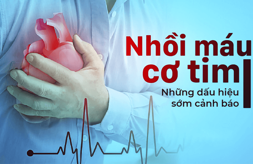 Nhồi máu cơ tim cấp: Nguyên nhân, biểu hiện, điều trị và phòng bệnh