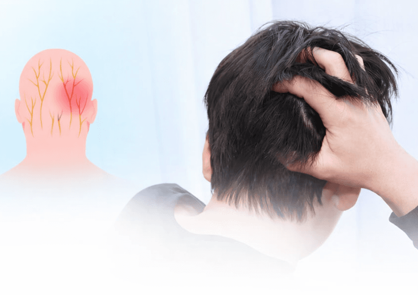 Đau dây thần kinh là gì? Những điều cần biết về đau dây thần kinh