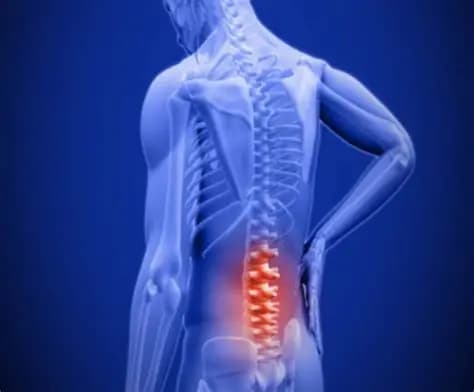 Nguyên Nhân Gây Đau Vùng Xương Cụt Và Cách Cải Thiện Hiệu Quả