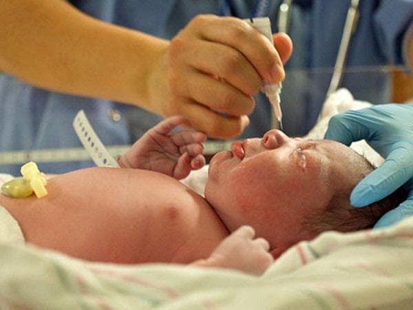 Bệnh võng mạc trẻ sinh non là gì? Những điều cần biết về bệnh võng mạc trẻ sinh non