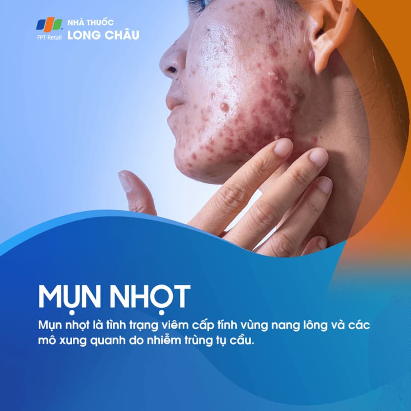 Mụn nhọt là gì? Nguyên nhân gây ra Mụn nhọt và nguyên tắc phòng ngừa