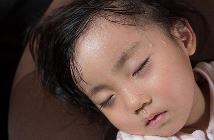 Đổ mồ hôi trộm là gì? Những điều cần biết về đổ mồ hôi trộm