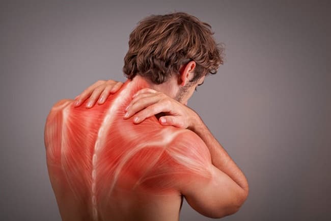 Viêm cơ là gì? Nguyên nhân, triệu chứng, phương pháp phòng ngừa