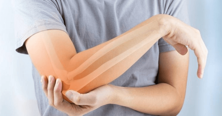 Thiếu canxi là gì? Những điều cần biết về thiếu canxi