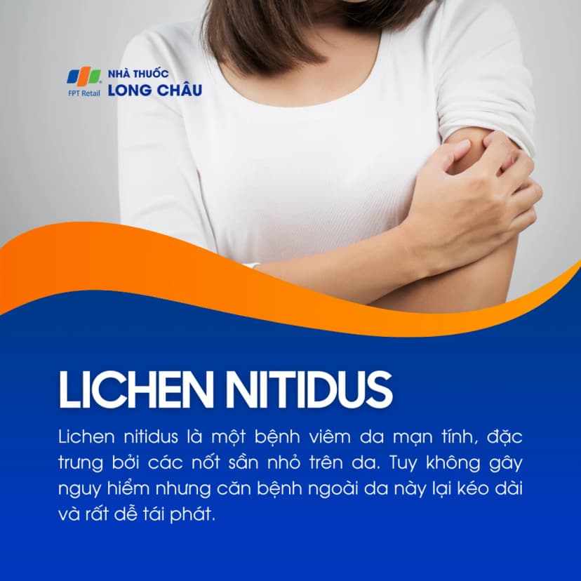 Lichen nitidus là gì? Nguyên nhân gây bệnh và phương pháp phòng ngừa