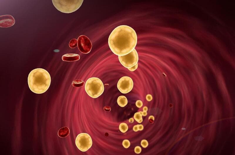 Rối loạn lipid máu là gì? Những điều cần biết về rối loạn lipid máu