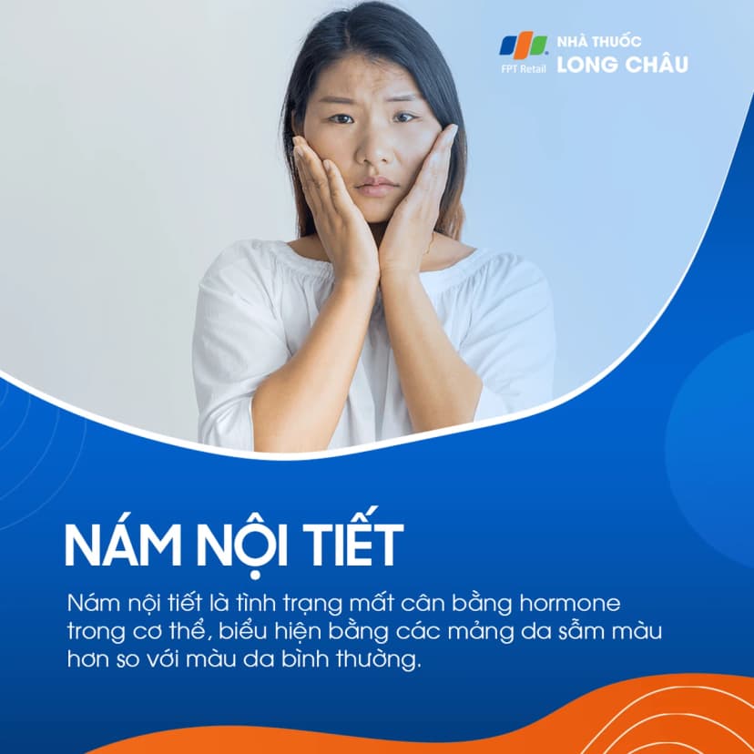 Nám nội tiết là gì? Điều trị và phòng ngừa ra sao?