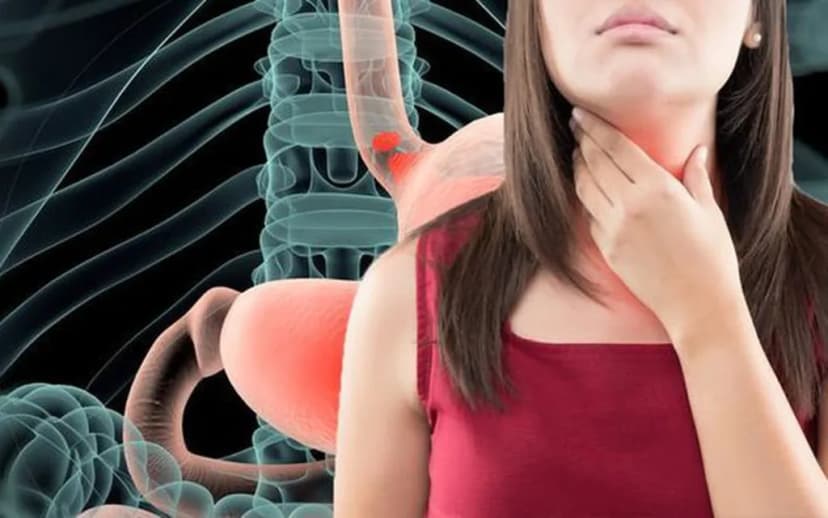 Ợ Nóng: Tổng Quan, Nguyên Nhân, Triệu Chứng và Cách Điều Trị