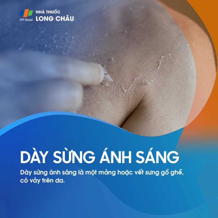 Bệnh dày sừng ánh sáng là gì? Nguyên nhân, triệu chứng và phương pháp điều trị