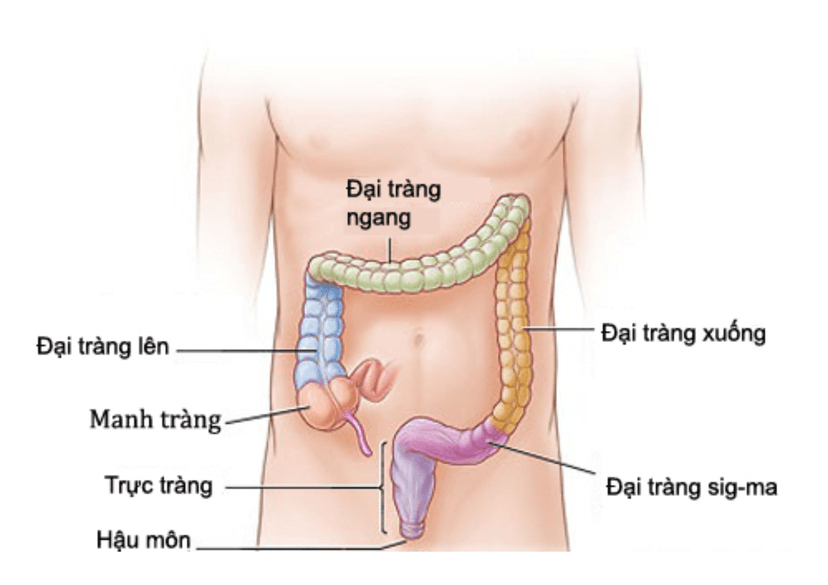 Ung thư ruột kết là gì? Những điều cần biết về ung thư ruột kết