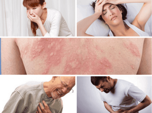 Sốc phản vệ là gì? Nguyên nhân, triệu chứng, phòng ngừa và cách xử trí