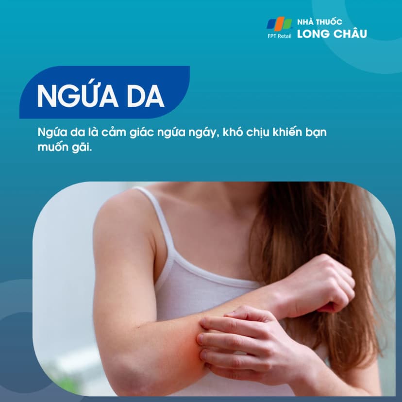 Ngứa là gì? Nguyên nhân gây bệnh và nguyên tắc phòng ngừa