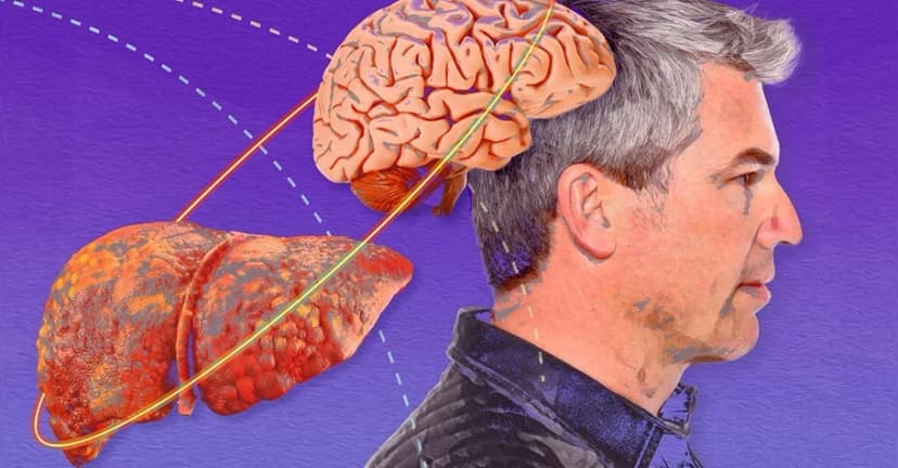Não gan là gì? Những điều cần biết về bệnh não gan