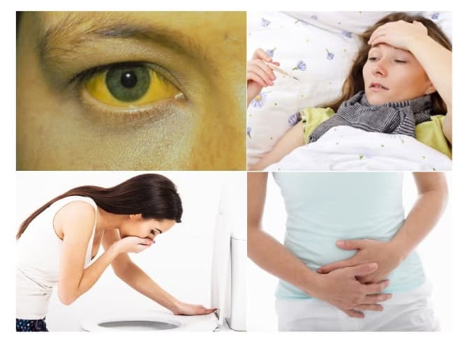 Vỡ Túi Mật: Nguyên nhân, dấu hiệu cảnh báo và cách điều trị về bệnh này