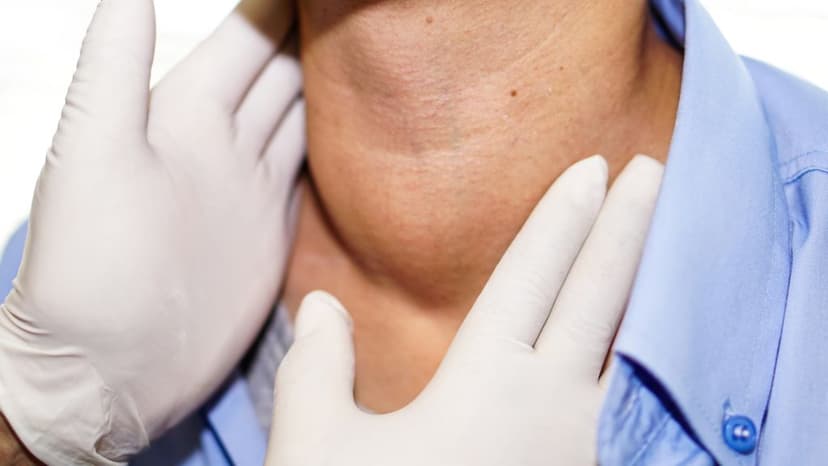 Bướu giáp nhân thùy phải là gì? Những điều cần biết về bướu giáp nhân thùy phải
