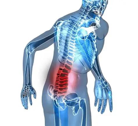Đau Thắt Lưng Là Gì? Triệu Chứng, Nguyên Nhân Và Cách Điều Trị Hiệu Quả