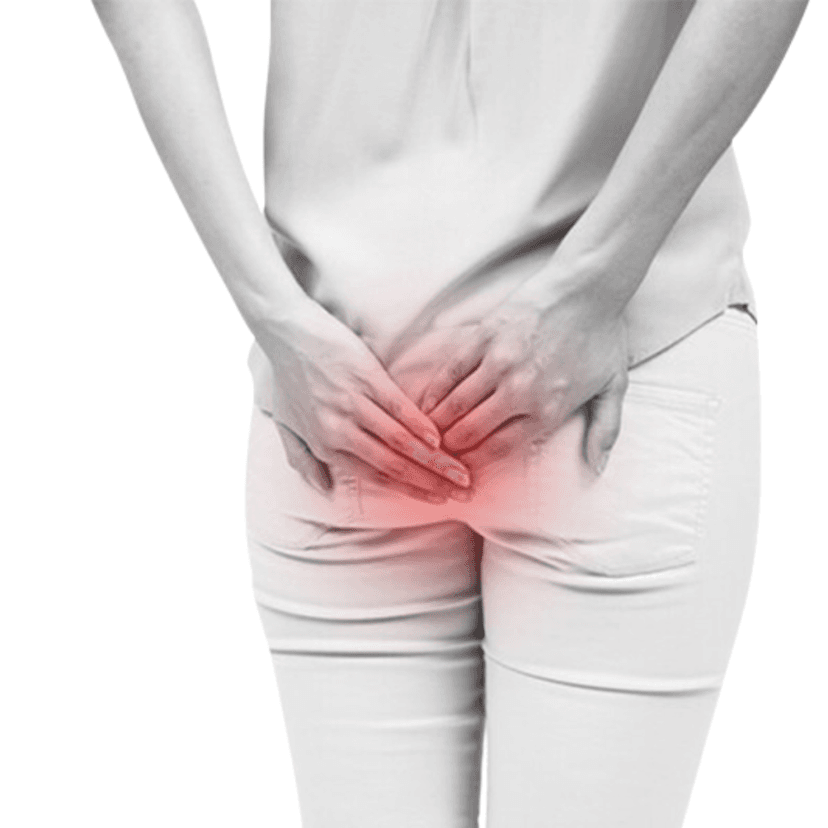 Khe nứt và lỗ rò hậu môn: Những điều bạn cần biết