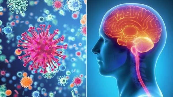 Rỗ Não Là Gì? Những Điều Cần Biết Về Bệnh Rỗ Não (Porencephaly)