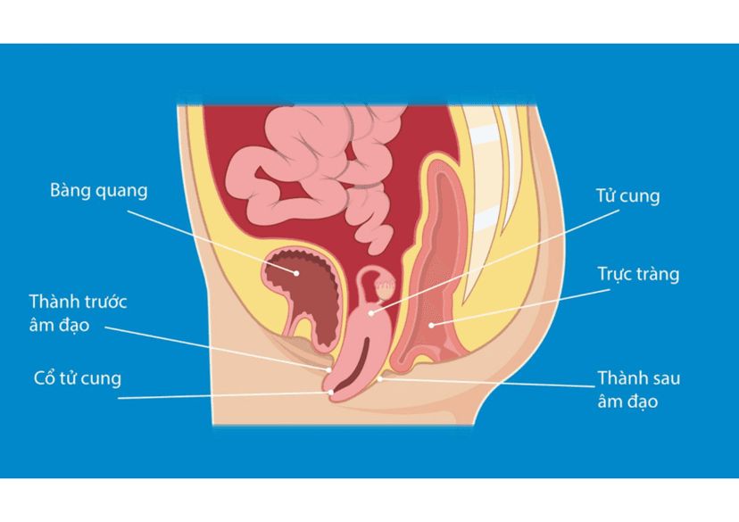 Sa tạng chậu là gì? Nguyên nhân, triệu chứng và cách phòng ngừa hiệu quả