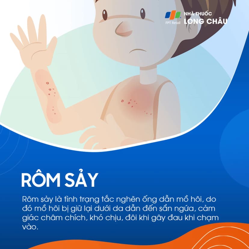 Rôm sảy là gì? Nguyên nhân gây bệnh và nguyên tắc phòng ngừa