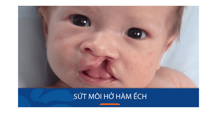 Răng hàm mặt