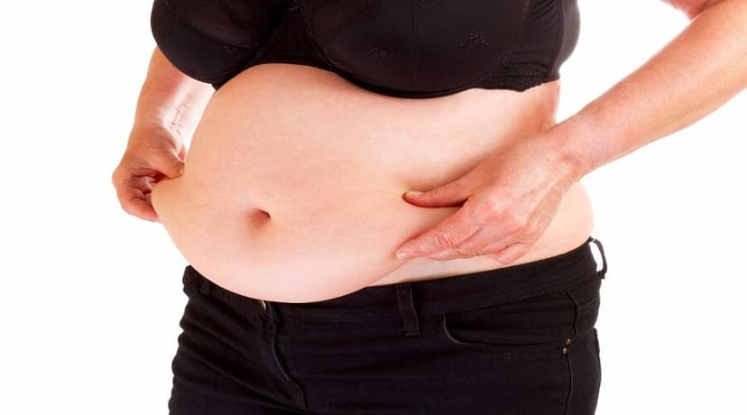Loạn dưỡng mỡ là gì? Những điều cần biết về loạn dưỡng mỡ