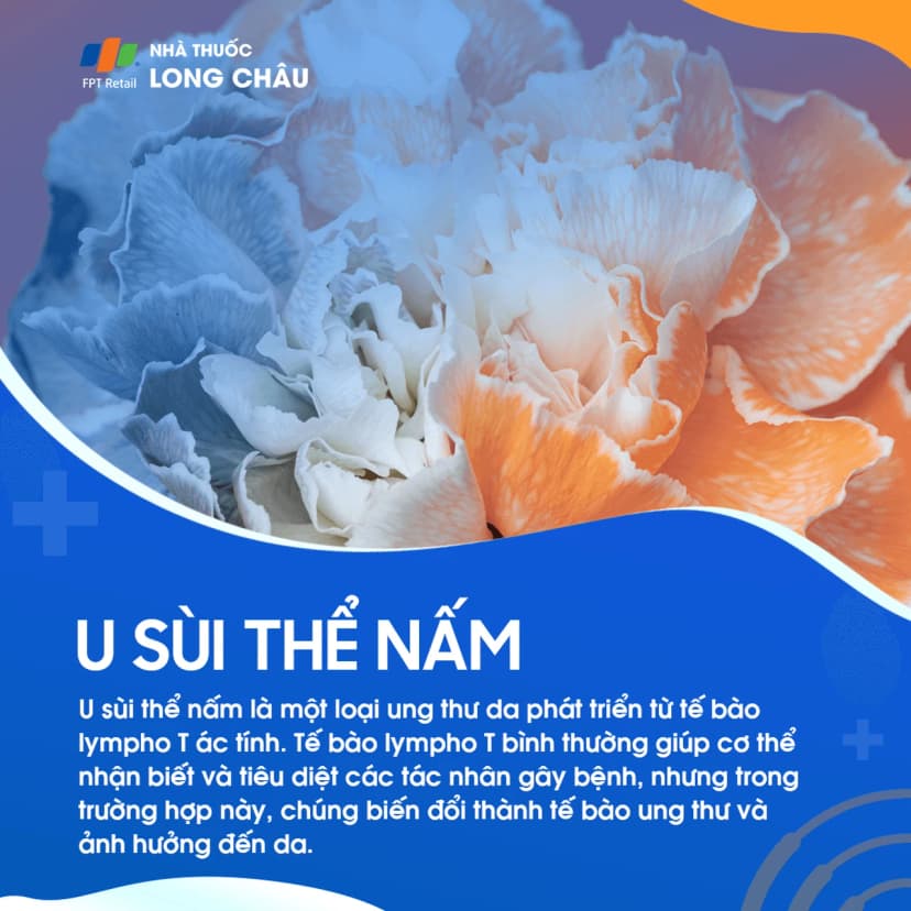 U sùi thể nấm: Nguyên nhân, triệu chứng và hướng điều trị