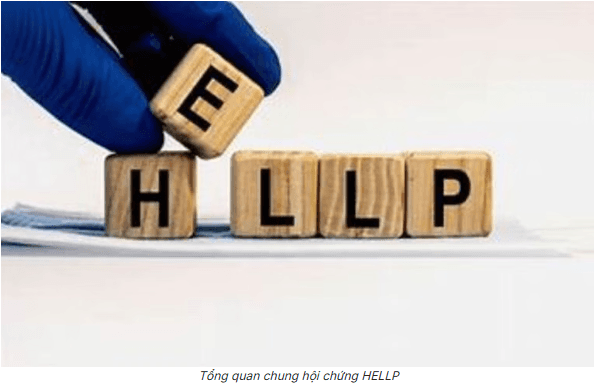 Hội chứng HELLP là gì? Những điều cần biết về hội chứng HELLP