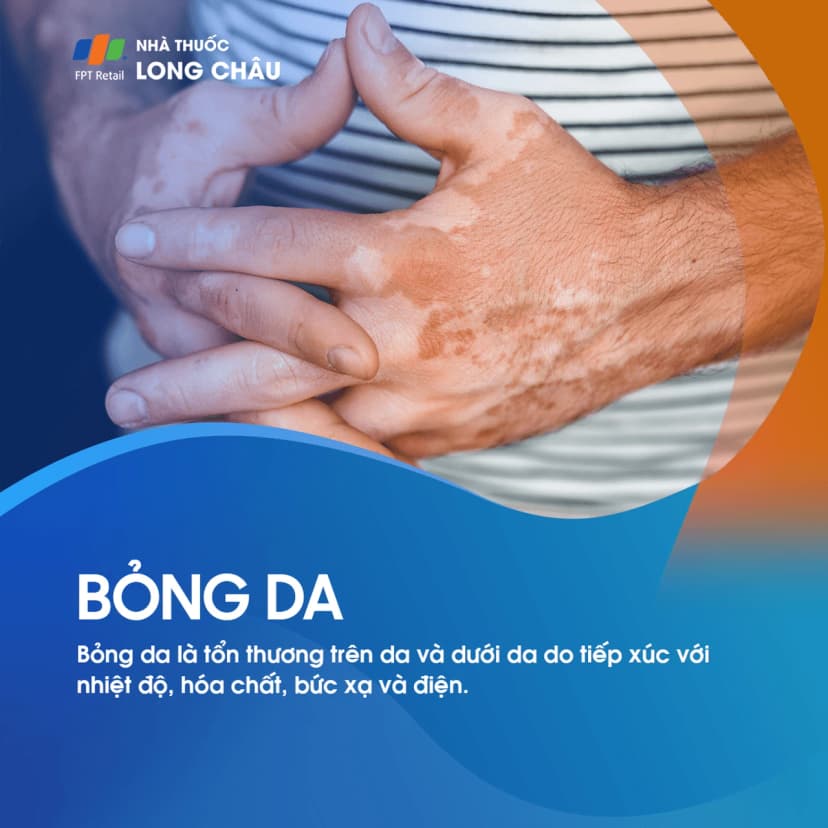 Bỏng da: Dấu hiệu bỏng từng cấp độ và phương pháp điều trị