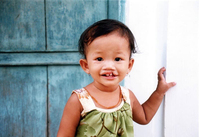 Hội chứng Kallmann là gì? Dấu hiệu, nguyên nhân, chẩn đoán và điều trị