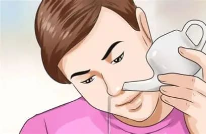 Polyp mũi: Nguyên nhân, triệu chứng, cách điều trị và phòng bệnh