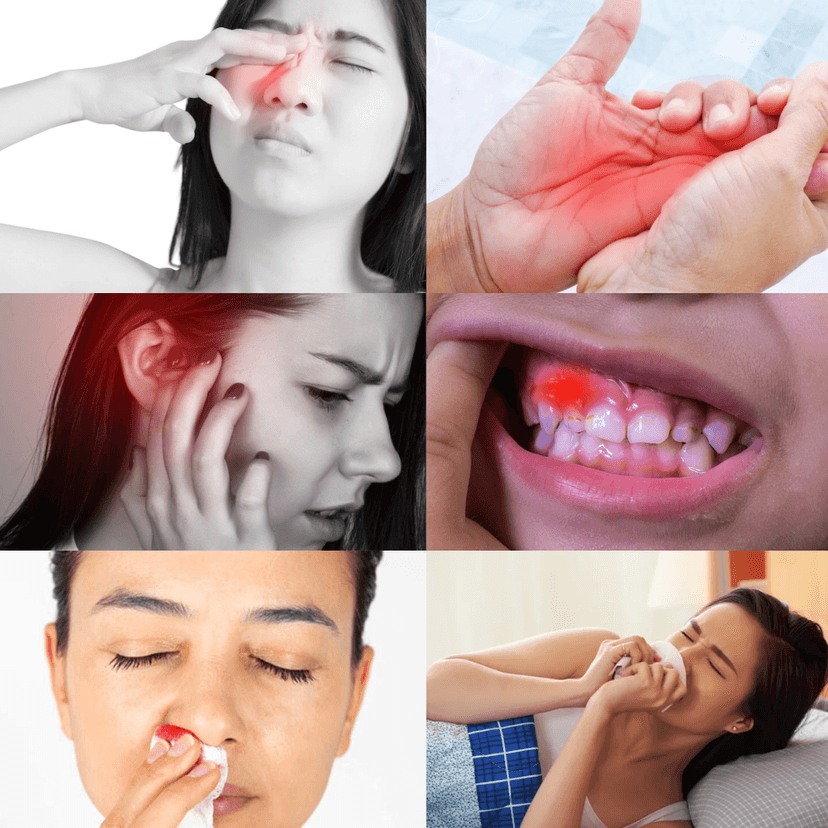 U Hốc Mũi: Nguyên Nhân, Dấu Hiệu và Các Phương Pháp Điều Trị