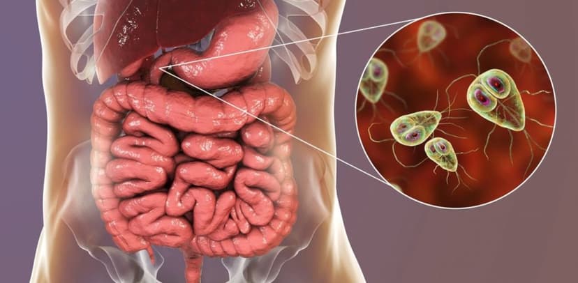 Nhiễm trùng đường ruột là gì? Triệu chứng, nguyên nhân và những cách phòng bệnh