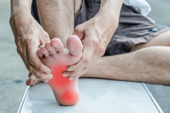 Viêm cân gan chân là gì? Những điều cần biết về viêm cân gan chân