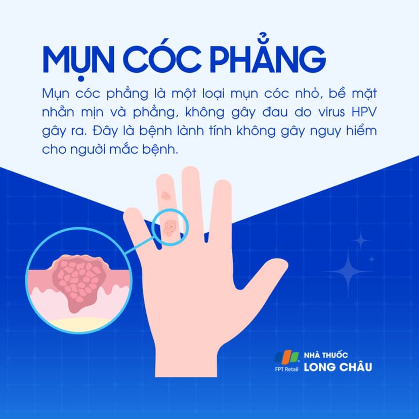Mụn cóc phẳng: Dấu hiệu nhận biết, nguyên nhân và cách phòng ngừa