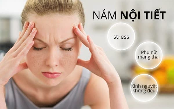 Nám nội tiết là gì? Những điều cần biết về nám nội tiết