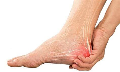 Đau Gót Chân: Nguyên Nhân, Triệu Chứng Và Cách Điều Trị Hiệu Quả