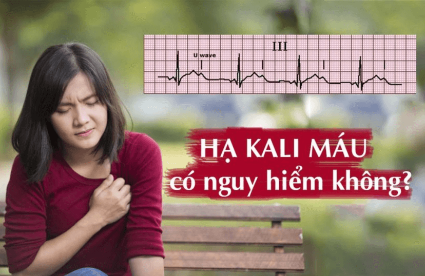 Hạ kali máu: Nguyên nhân, biểu hiện, cách điều trị và phòng bệnh