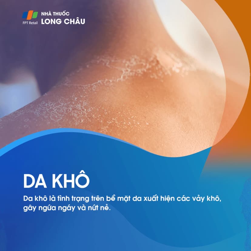Da khô: Nguyên nhân, biểu hiện và cách điều trị