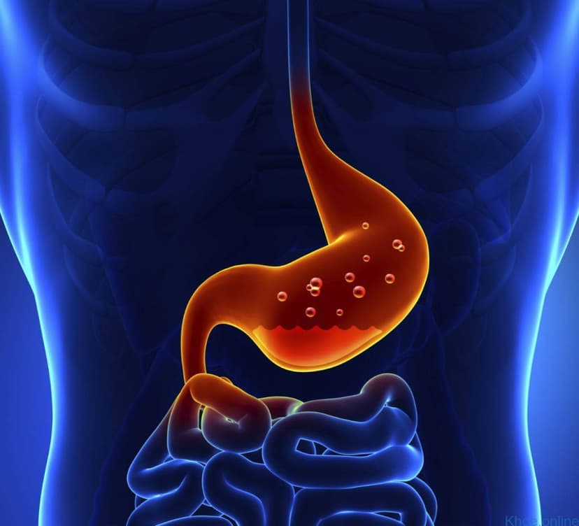 Polyp dạ dày là gì? Triệu chứng, nguyên nhân và phương pháp điều trị bệnh
