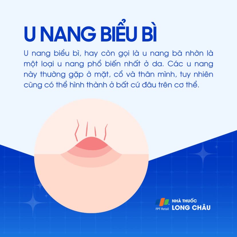 U nang biểu bì là gì? Nguyên nhân, triệu chứng và cách điều trị