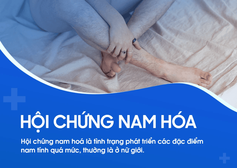 Hội chứng nam hóa: Nguyên nhân, triệu chứng, chẩn đoán và điều trị