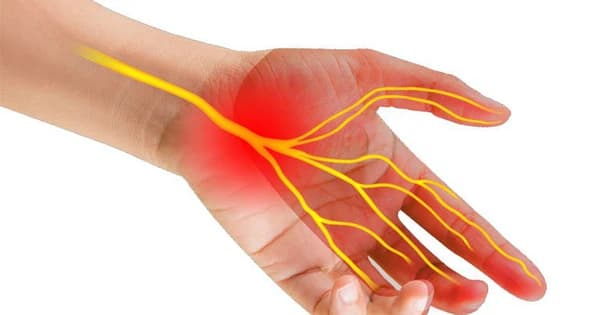 Tê bàn tay: Nguyên nhân, triệu chứng, điều trị và cách phòng ngừa