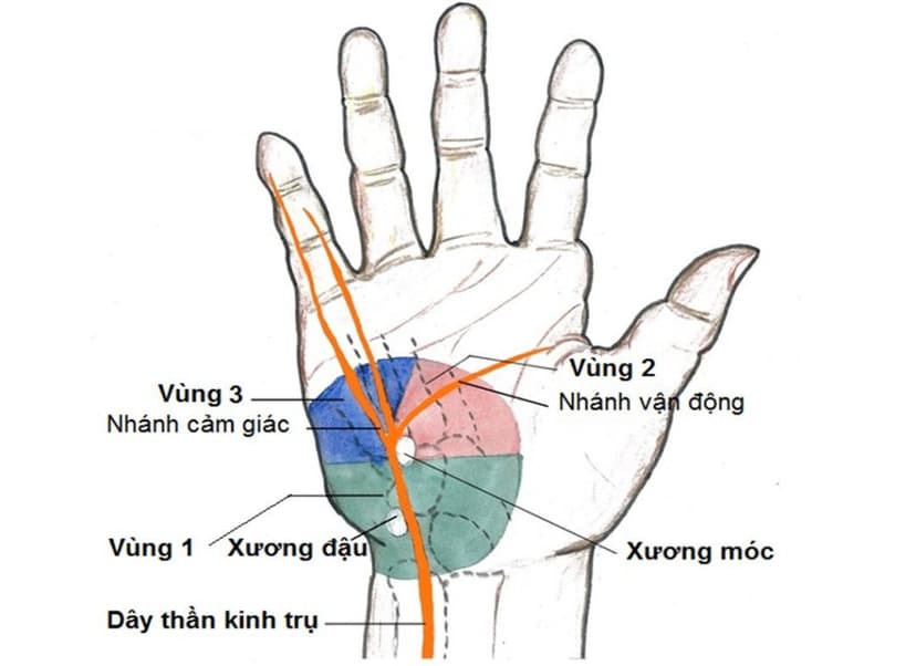 Rối loạn dây thần kinh trụ là gì? Những điều cần biết về rối loạn dây thần kinh trụ
