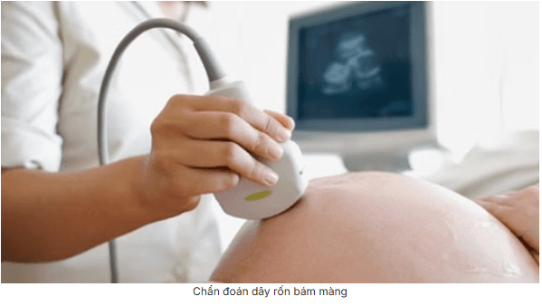 Dây Rốn Bám Màng Là Gì? Triệu Chứng, Nguyên Nhân Và Cách Điều Trị