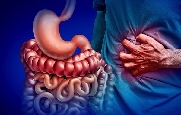 Bệnh Crohn là gì? Triệu chứng, nguyên nhân và các phương pháp điều trị bệnh